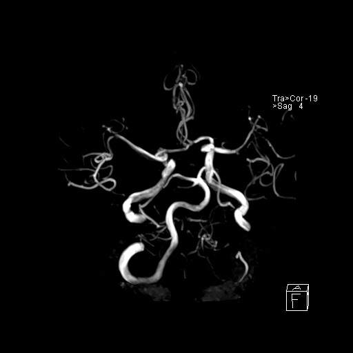 Click on the Serie image to view the images of VILLANUEVA, WILLIAM A.